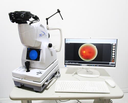 Topcon NW8 Fundus Retinal Camera w/ External Fixation Target - Complete