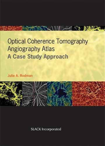 Optical Coherence Tomography Angiography Atlas: A Case Study Approach by Dan Esm