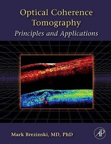 OPTICAL COHERENCE TOMOGRAPHY: PRINCIPLES AND APPLICATIONS By Mark E. Brezinski