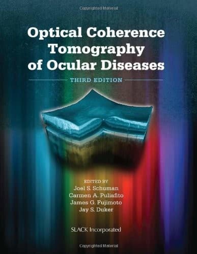 OPTICAL COHERENCE TOMOGRAPHY OF OCULAR DISEASES By Schuman Joel S. Md NEW